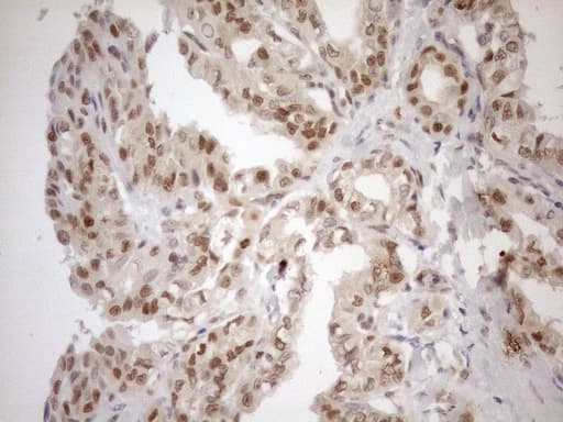 MGMT Antibody (clone OTI2E2)