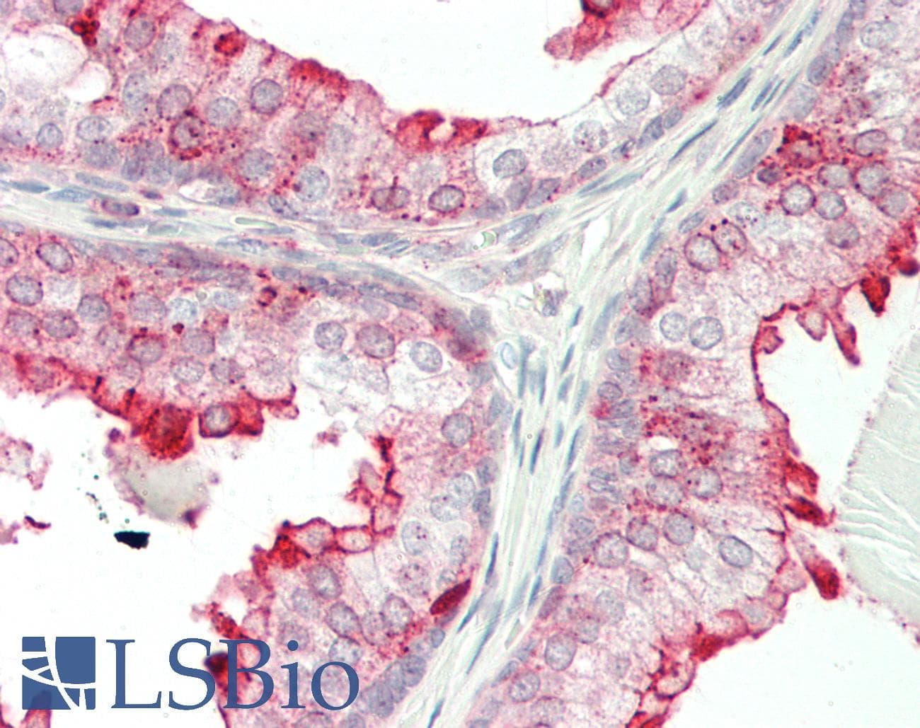IHC-plus™ Polyclonal Rabbit anti-Human ANXA1 / Annexin A1 Antibody (aa129-158, IHC, WB)
