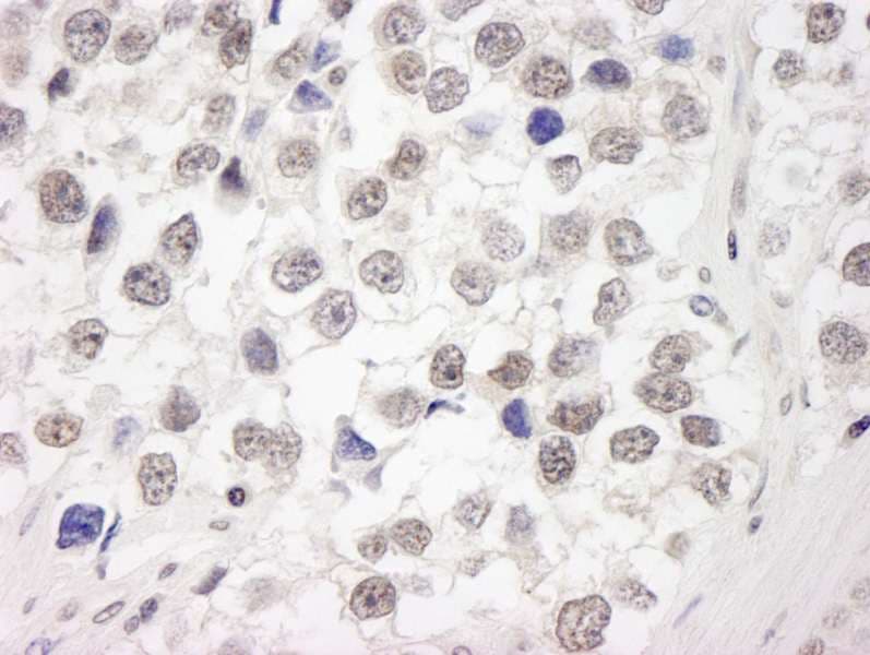 UIMC1 / RAP80 Antibody (aa650-C-term)