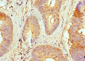TP53BP1 / 53BP1 Antibody (aa1758-1972)