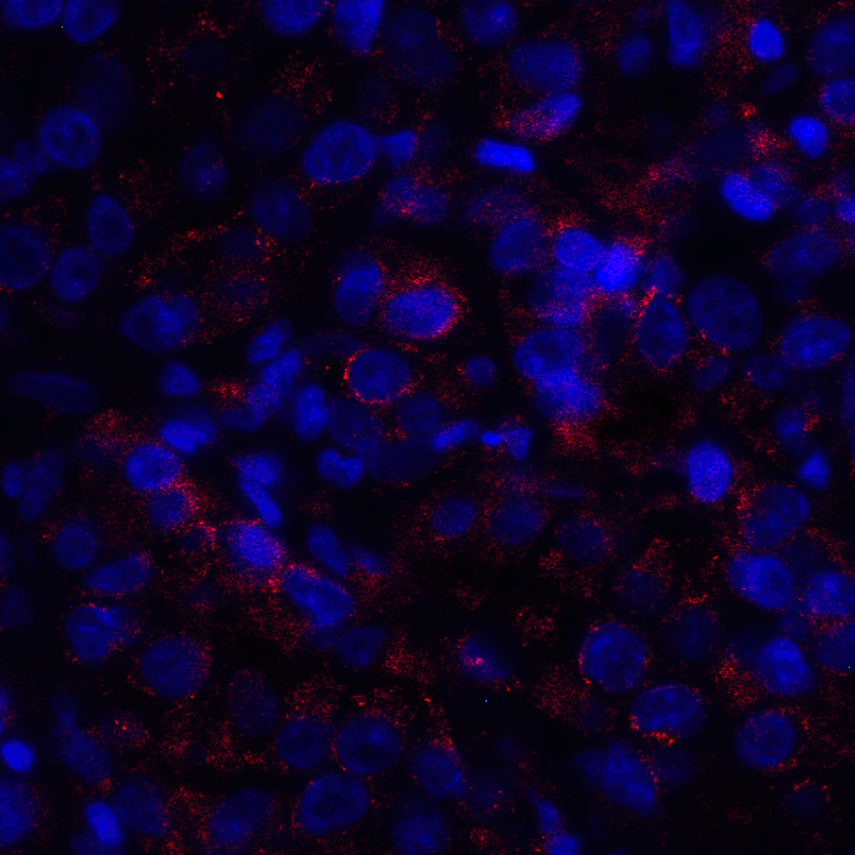 IHC-plus™ VSIR / GI24 / VISTA Antibody (clone 8E11)
