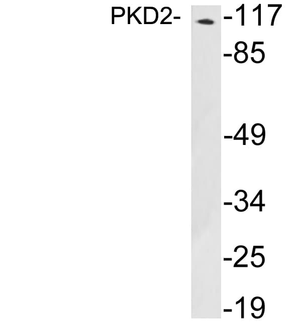 Polyclonal Rabbit anti-Human PRKD2 / PKD2 Antibody (aa827-876, WB)