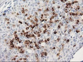 MGLL / Monoacylglycerol Lipase Antibody (clone OTI2G8)