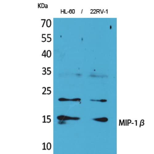CCL4 / MIP-1 Beta Antibody (31-80 aa, Internal)
