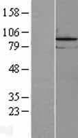 LOC81691 Protein (Over-Expression Lysate Myc-DDK (Flag))
