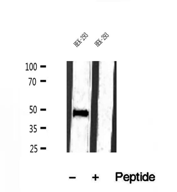 IFT57 / HIPPI Antibody