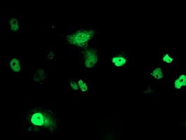 PHF21B Antibody (clone OTI4C5)