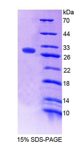 Mouse FPGS Protein (Recombinant His-T7)