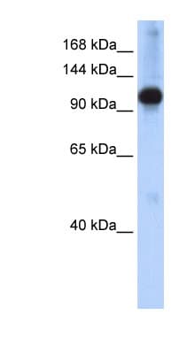 SMARCAL1 Antibody (N-Terminus)