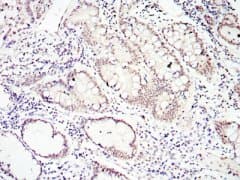 SMAD4 Antibody (clone 4G1C6)