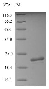 Pig GOB5 / CLCA1 Protein (Recombinant 10His, N-terminus + Myc, C-terminus)