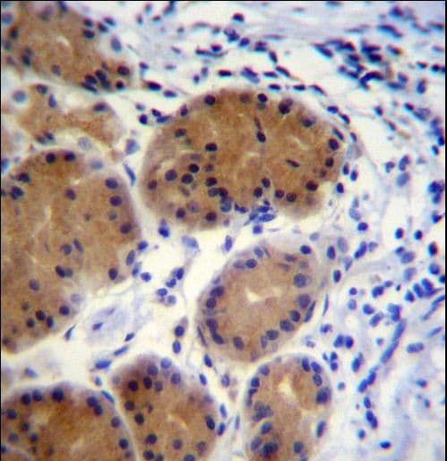 Polyclonal Rabbit anti-Human MORN5 Antibody (aa93-122, IHC, WB)