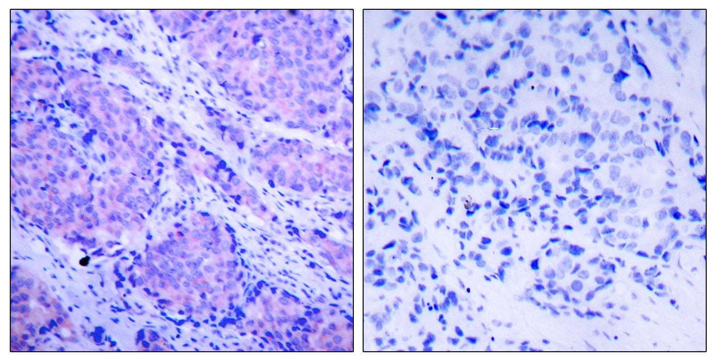 PDPK1 / PDK1 Antibody (phospho-Ser241)
