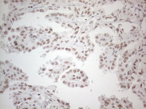 NR2C2 / TAK1 Antibody (aa1-241, clone OTI2H2)