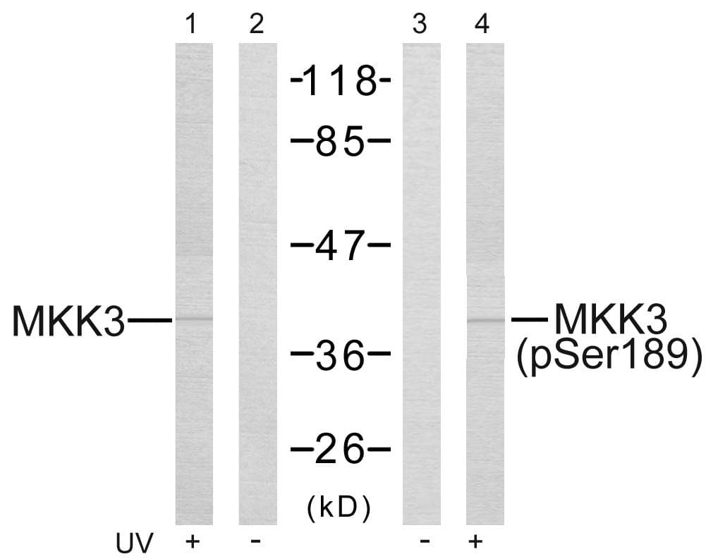 MAP2K6 / MEK6 / MKK6 Antibody (phospho-Ser207)