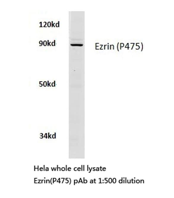 EZR / Ezrin Antibody (Pro475)