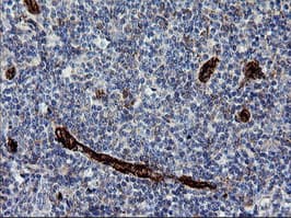ROMO1 Antibody (clone OTI1G4)