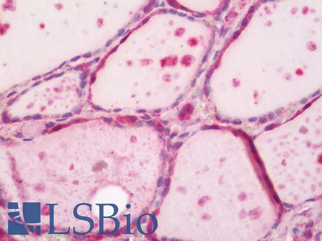 IHC-plus™ Polyclonal Rabbit anti-Human XRG8 / XKR8 Antibody (IHC, IF, WB)