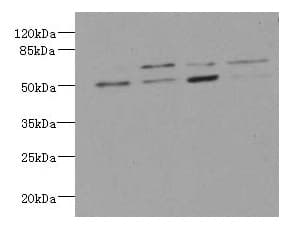LDB3 / ZASP Antibody