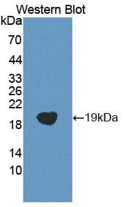 CLP / COTL1 Antibody (aa1-142, PE)