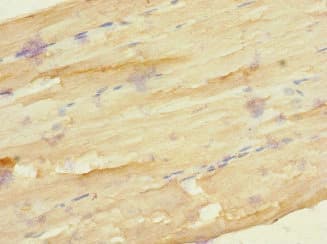 FZD3 / Frizzled 3 Antibody