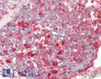 IHC-plus™ Beta Tubulin Antibody (clone 2G7D4)