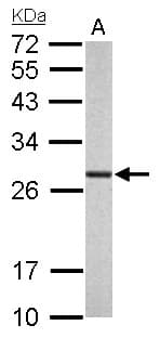 Polyclonal Rabbit anti-Human PSMA6 Antibody (aa57-274, IHC, WB)