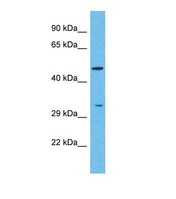 Polyclonal Rabbit anti-Human PNLIPRP2 Antibody (aa329-378, WB)