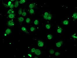 Paraplegin / SPG7 Antibody (clone OTI3H10)