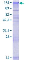 Human HIPK1 Protein (Recombinant GST)