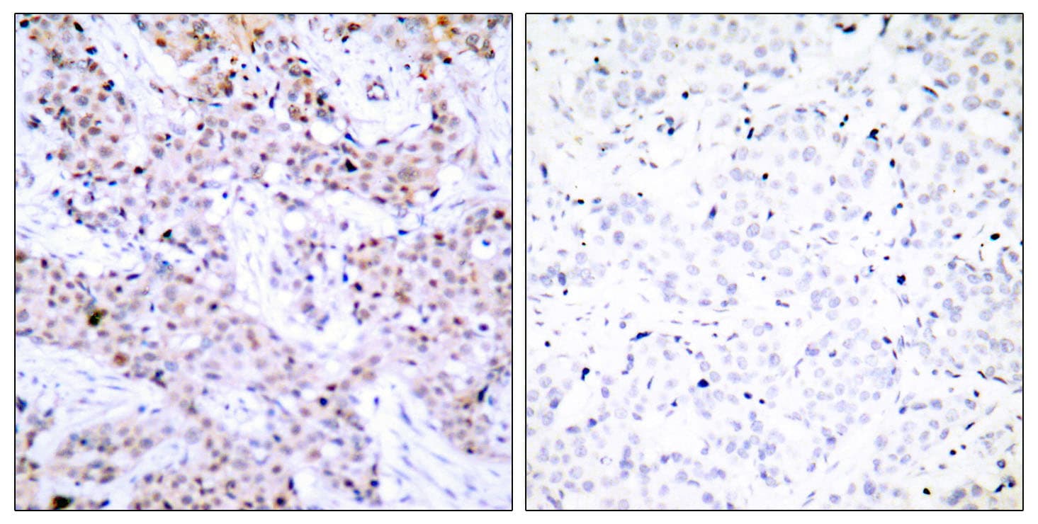 ER Alpha / Estrogen Receptor Antibody (aa71-120)