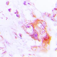 EIF2AK2 / PKR Antibody (phospho-Thr451)