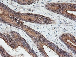 UBE2G2 Antibody (clone OTI1D7)
