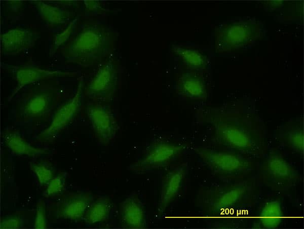 MAPKAPK2 / MAPKAP Kinase 2 Antibody (clone 2B3)