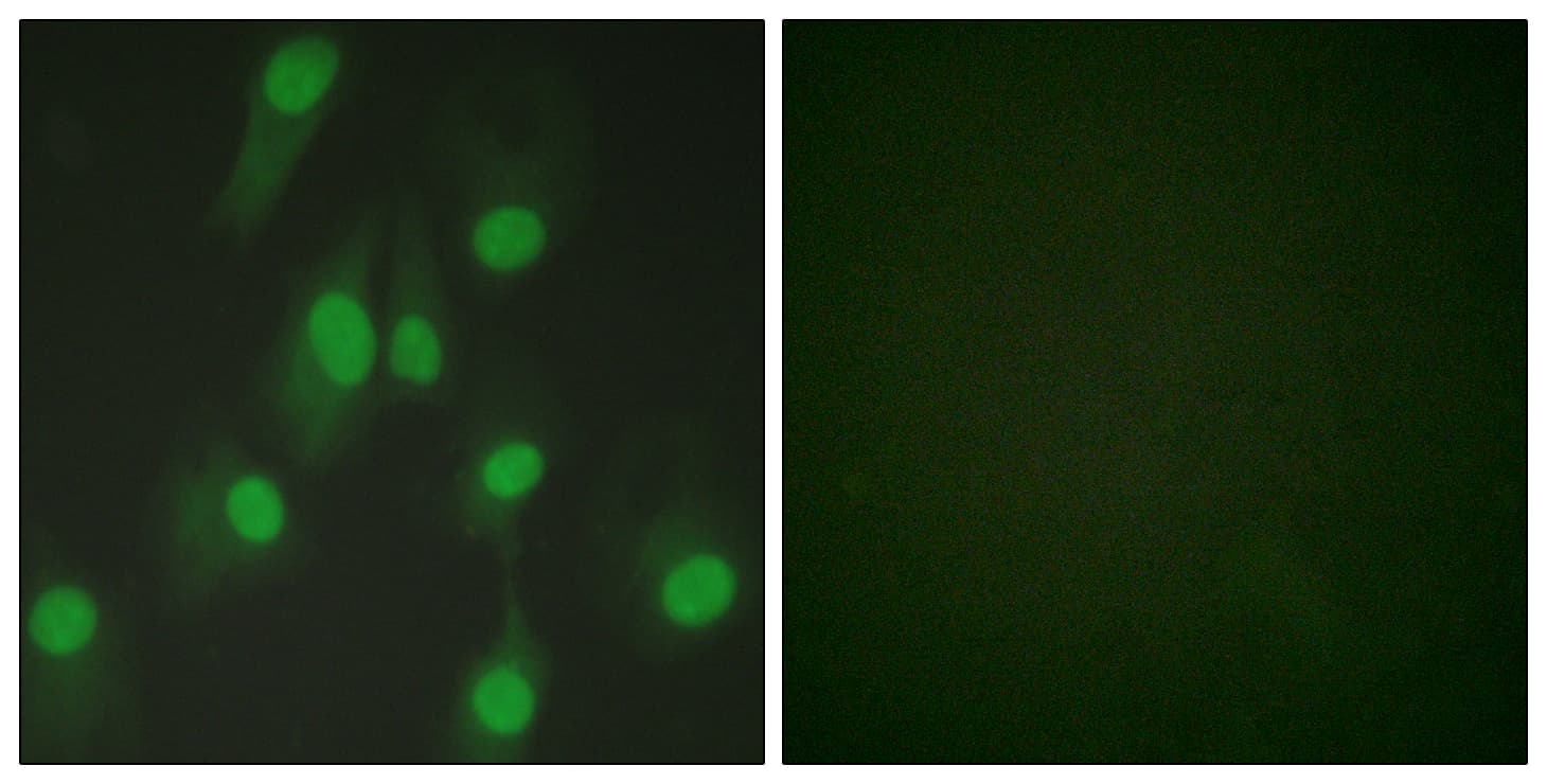 Polyclonal Rabbit anti-Human CHEK1 / CHK1 Antibody (aa256-305, IF, WB)
