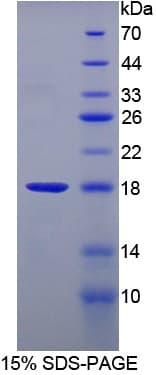 Pig FABP3 / H-FABP Protein (Recombinant His-T7)