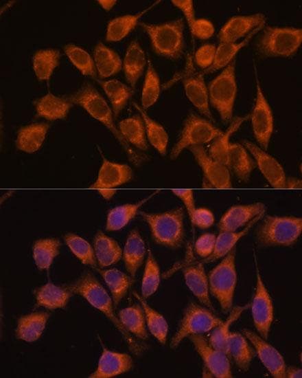 UBQLNL Antibody