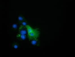 EPHX2 / Epoxide Hydrolase 2 Antibody (clone OTI1A6, Carrier-free)