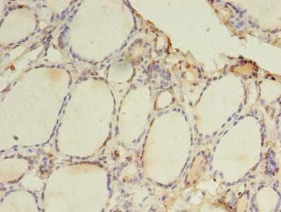 TLR6 Antibody