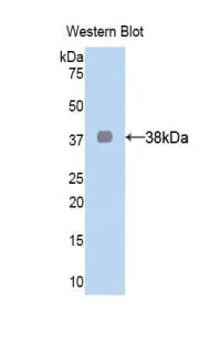 LDHA / LDH1 Antibody (aa1-332, APC)