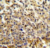 Polyclonal Rabbit anti-Human P40PHOX / NCF4 Antibody (aa260-289, IHC, WB)