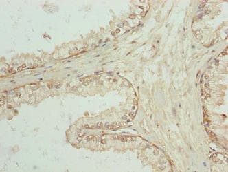 SPTLC3 / C20orf38 Antibody