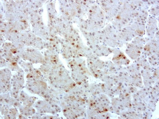 Monoclonal Mouse anti-Human S100P Antibody (clone UMAB24, IHC, IF, WB)