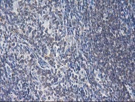 MAPRE2 / EB2 Antibody (clone OTI1D10)