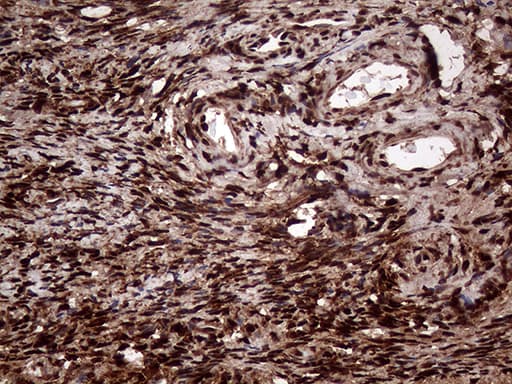 Monoclonal Mouse anti-Human TALDO1 / Transaldolase 1 Antibody (clone OTI1E5, IHC, WB)