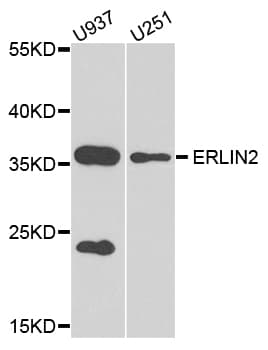 Polyclonal Rabbit anti-Human SPFH2 / ERLIN2 Antibody (WB)