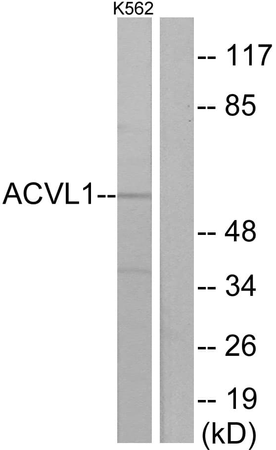 PathPlus™ ACVRL1 Antibody (aa196-245)