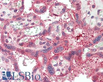 IHC-plus™ Polyclonal Rabbit anti-Human RAB11B Antibody (IHC, WB)