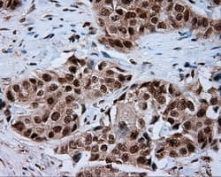NPR3 Antibody (clone OTI4C3)