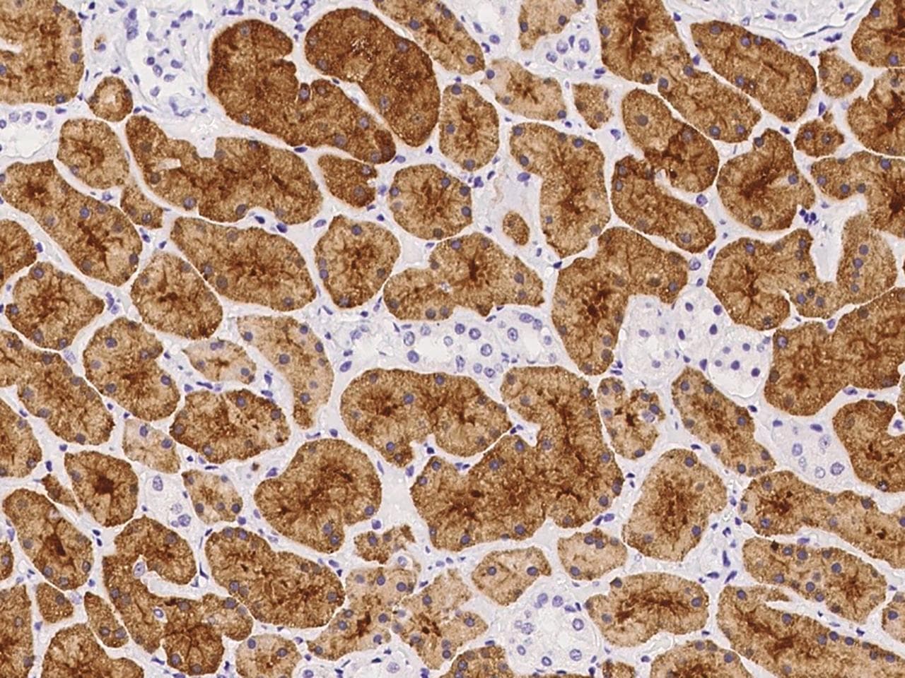 FTL / Ferritin Light Chain Antibody